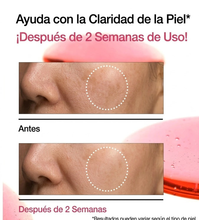 ANUA - SUERO NIACINAMIDE 10 + TXA 4 SERUM 30ML