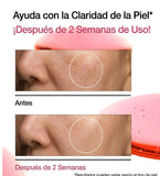 ANUA - SUERO NIACINAMIDE 10 + TXA 4 SERUM 30ML