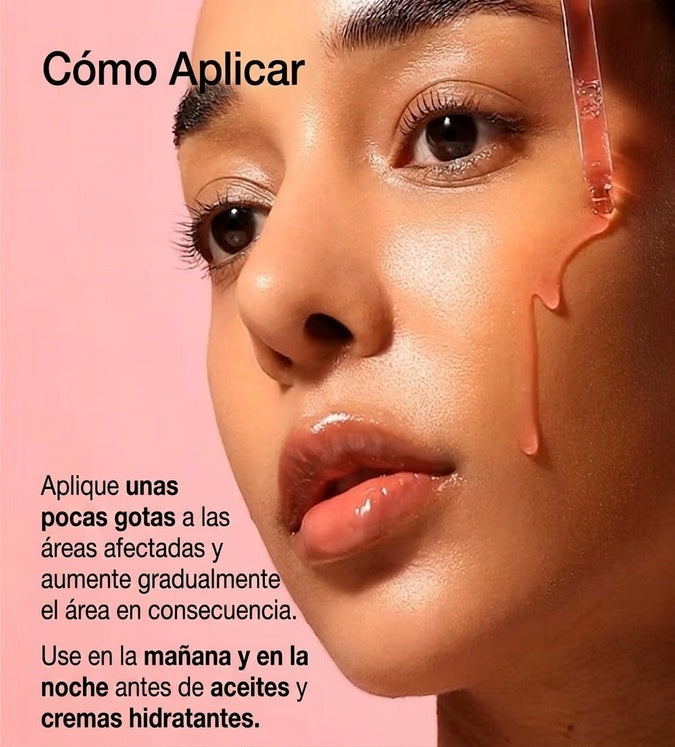 ANUA - SUERO NIACINAMIDE 10 + TXA 4 SERUM 30ML