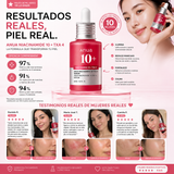 ✨ ANUA Niacinamide 10% + TXA 4% Serum – Piel Radiante, Uniforme y Sin Imperfecciones
